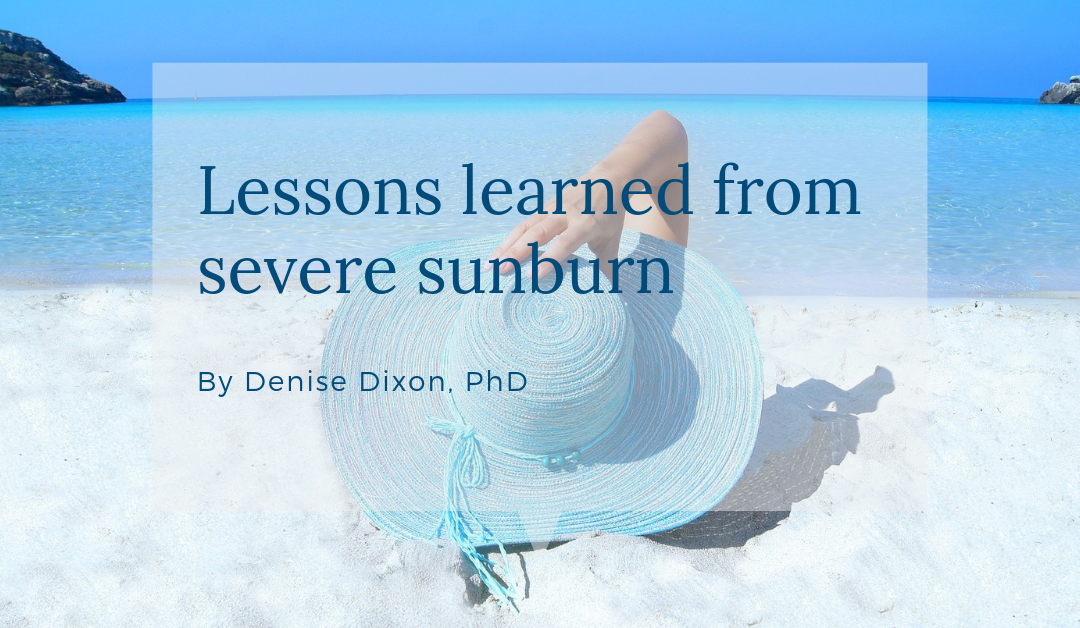 Lessons learned from severe sunburn